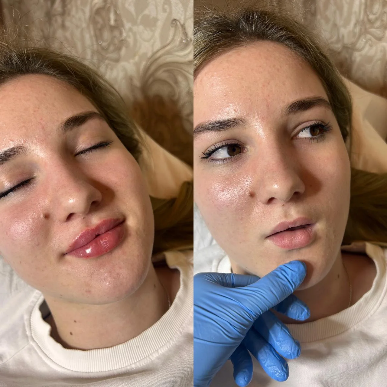 Realizacja Elixir Młodości 1