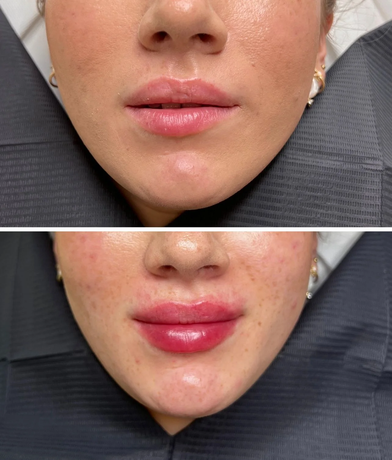 Realizacja modelowania ust KM Lips & Skin — kadr 05