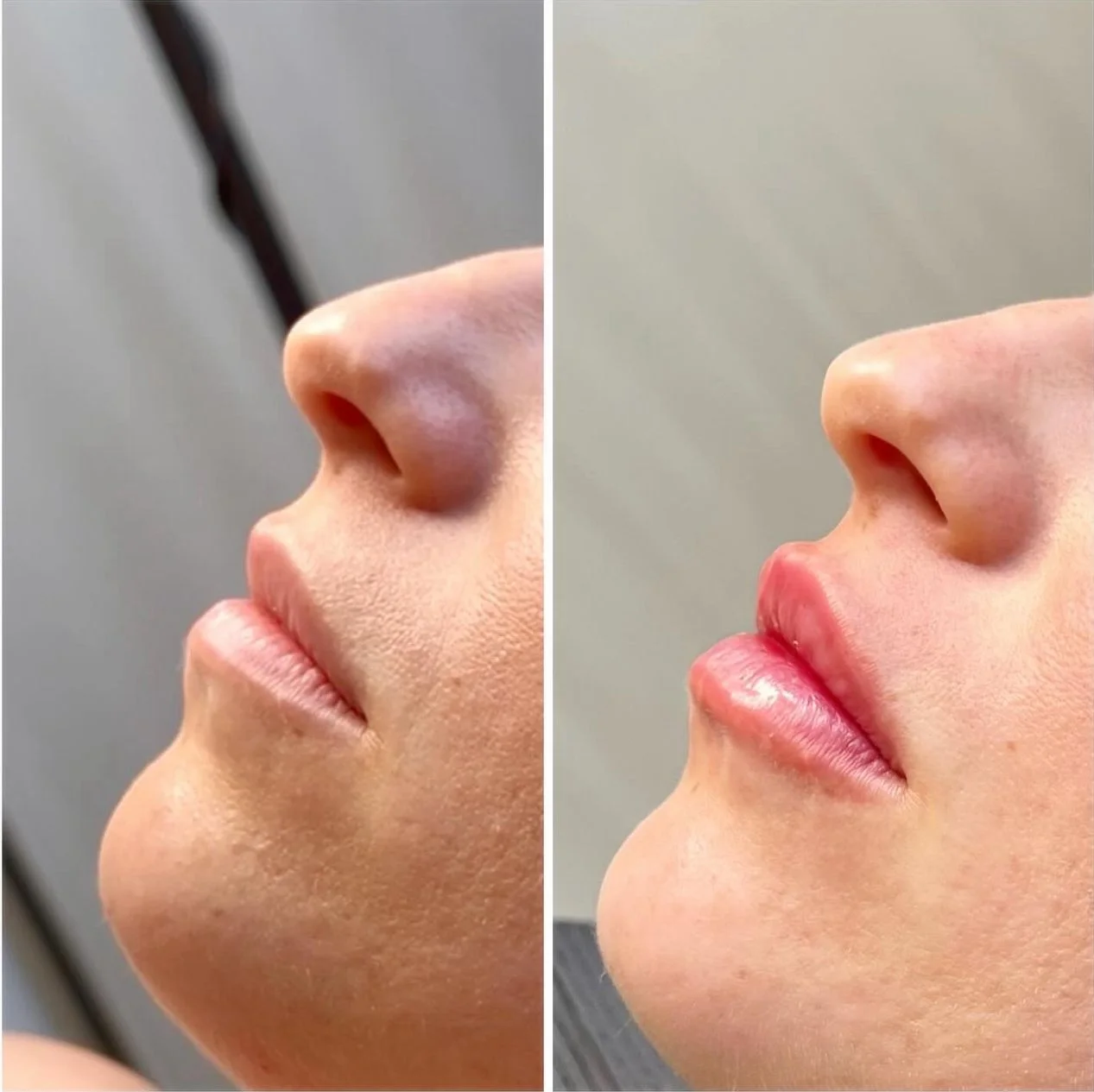 Realizacja modelowania ust KM Lips & Skin — kadr 07