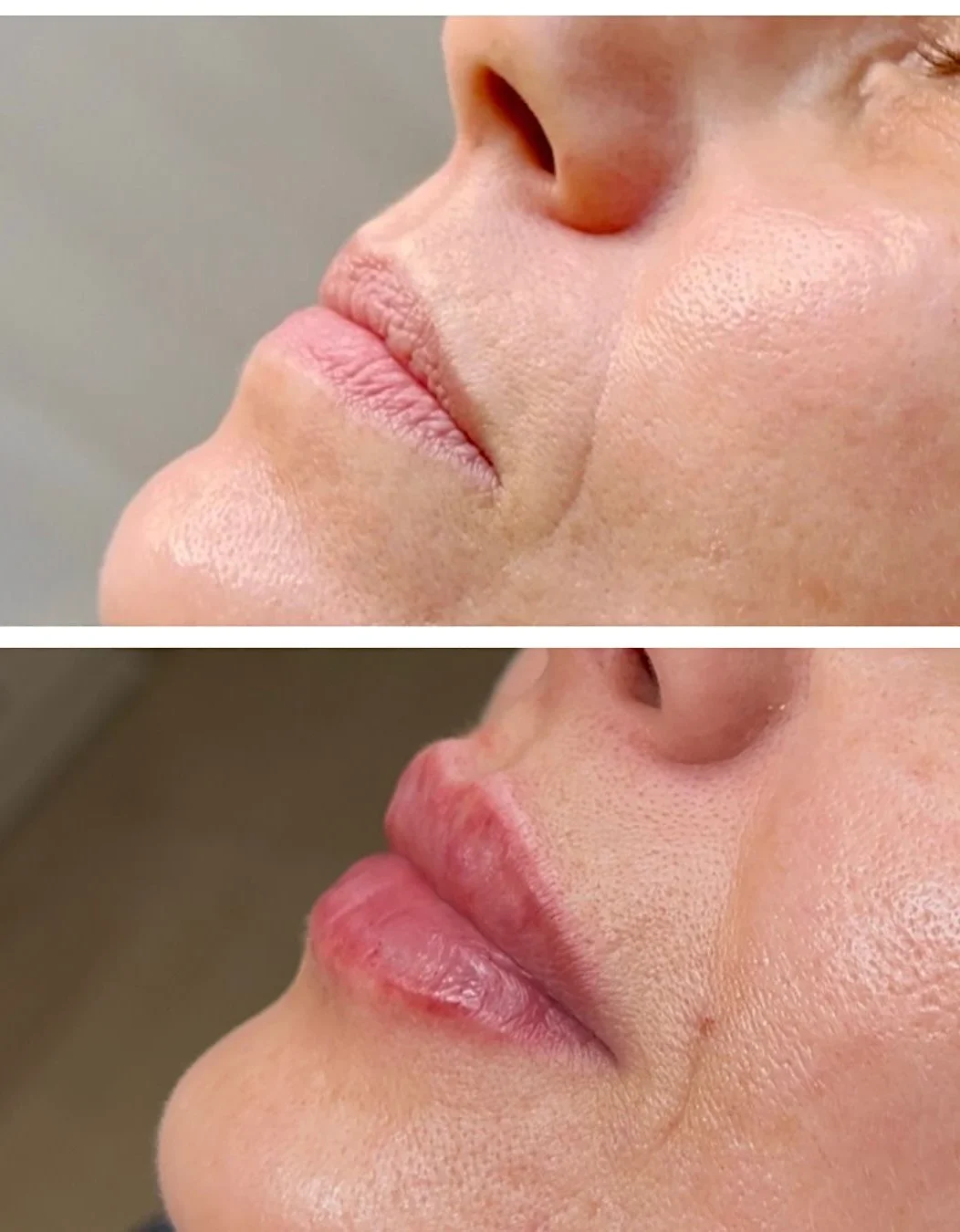 Realizacja modelowania ust KM Lips & Skin — kadr 01